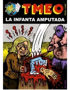 es::Tmeo 125 - La Infanta Amputada