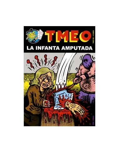 es::Tmeo 125 - La Infanta Amputada